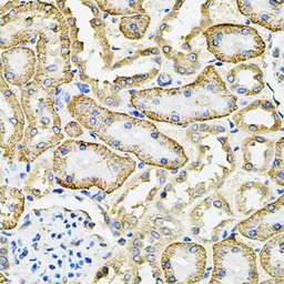 Anti-SLC4A4 antibody used in IHC (Paraffin sections) (IHC-P). GTX54676