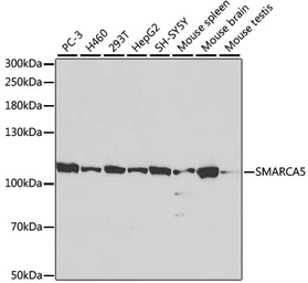Anti-SNF2H antibody used in Western Blot (WB). GTX54677