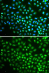 Anti-SNF2H antibody used in Immunocytochemistry/ Immunofluorescence (ICC/IF). GTX54677