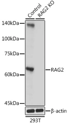 Anti-RAG2 antibody used in Western Blot (WB). GTX54683
