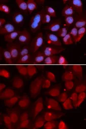 Anti-RAG2 antibody used in Immunocytochemistry/ Immunofluorescence (ICC/IF). GTX54683