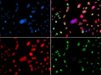Anti-RAG2 antibody used in Immunocytochemistry/ Immunofluorescence (ICC/IF). GTX54683