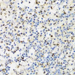 Anti-SUMO4 antibody used in IHC (Paraffin sections) (IHC-P). GTX54685