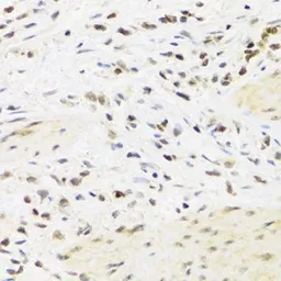 Anti-SUMO4 antibody used in IHC (Paraffin sections) (IHC-P). GTX54685