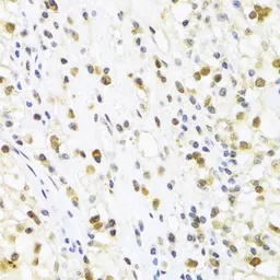 Anti-SUMO4 antibody used in IHC (Paraffin sections) (IHC-P). GTX54685