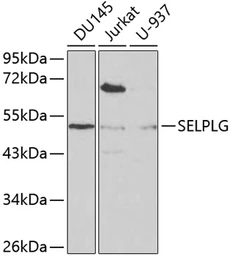 Anti-CD162 antibody used in Western Blot (WB). GTX54688