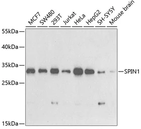 Anti-SPIN1 antibody used in Western Blot (WB). GTX54689