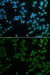 Anti-SPIN1 antibody used in Immunocytochemistry/ Immunofluorescence (ICC/IF). GTX54689