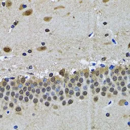 Anti-SPIN1 antibody used in IHC (Paraffin sections) (IHC-P). GTX54689