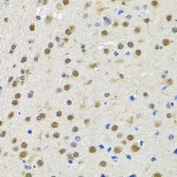 Anti-SPIN1 antibody used in IHC (Paraffin sections) (IHC-P). GTX54689