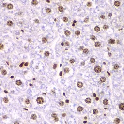 Anti-SSRP1 antibody used in IHC (Paraffin sections) (IHC-P). GTX54690