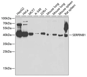 Anti-M/NEI antibody used in Western Blot (WB). GTX54692