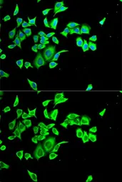 Anti-M/NEI antibody used in Immunocytochemistry/ Immunofluorescence (ICC/IF). GTX54692