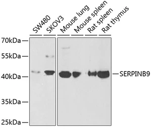 Anti-SerpinB9 antibody used in Western Blot (WB). GTX54693