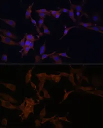 Anti-SerpinB9 antibody used in Immunocytochemistry/ Immunofluorescence (ICC/IF). GTX54693