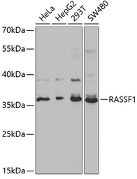 Anti-RASSF1 antibody used in Western Blot (WB). GTX54696