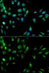 Anti-RASSF1 antibody used in Immunocytochemistry/ Immunofluorescence (ICC/IF). GTX54696
