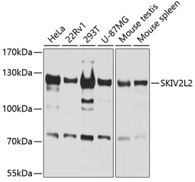 Anti-SKIV2L2 antibody used in Western Blot (WB). GTX54698