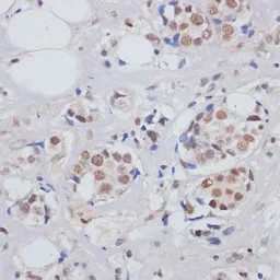 Anti-SKIV2L2 antibody used in IHC (Paraffin sections) (IHC-P). GTX54698