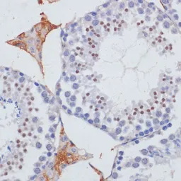 Anti-SKIV2L2 antibody used in IHC (Paraffin sections) (IHC-P). GTX54698