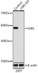 Anti-LKB1 antibody used in Western Blot (WB). GTX54702