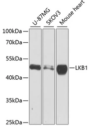 Anti-LKB1 antibody used in Western Blot (WB). GTX54702