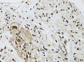 Anti-LKB1 antibody used in IHC (Paraffin sections) (IHC-P). GTX54702