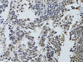 Anti-LKB1 antibody used in IHC (Paraffin sections) (IHC-P). GTX54702