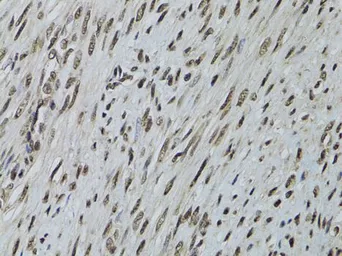 Anti-LKB1 antibody used in IHC (Paraffin sections) (IHC-P). GTX54702