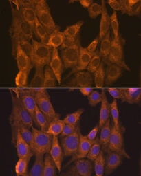 Anti-Retinoic Acid Receptor alpha antibody used in Immunocytochemistry/ Immunofluorescence (ICC/IF). GTX54703