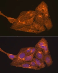 Anti-Retinoic Acid Receptor alpha antibody used in Immunocytochemistry/ Immunofluorescence (ICC/IF). GTX54703