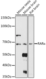 Anti-Retinoic Acid Receptor alpha antibody used in Western Blot (WB). GTX54703