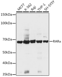 Anti-Retinoic Acid Receptor alpha antibody used in Western Blot (WB). GTX54703
