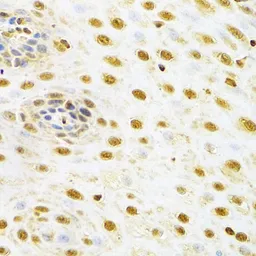 Anti-RUNX1 antibody used in IHC (Paraffin sections) (IHC-P). GTX54704