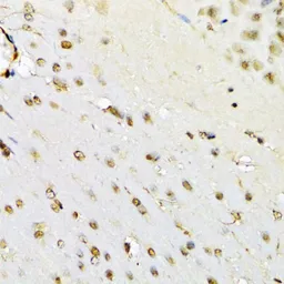 Anti-RUNX1 antibody used in IHC (Paraffin sections) (IHC-P). GTX54704