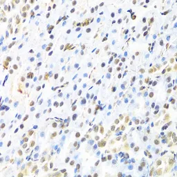 Anti-RUNX1 antibody used in IHC (Paraffin sections) (IHC-P). GTX54704