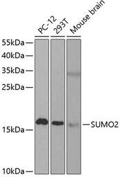 Anti-SUMO2 antibody used in Western Blot (WB). GTX54705