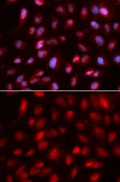 Anti-SUMO2 antibody used in Immunocytochemistry/ Immunofluorescence (ICC/IF). GTX54705