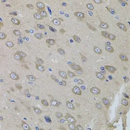 Anti-SUMO3 antibody used in IHC (Paraffin sections) (IHC-P). GTX54706