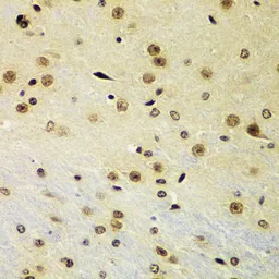 Anti-RNF2 antibody used in IHC (Paraffin sections) (IHC-P). GTX54707
