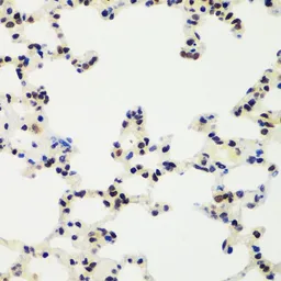 Anti-RNF2 antibody used in IHC (Paraffin sections) (IHC-P). GTX54707