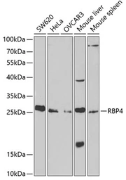 Anti-RBP4 antibody used in Western Blot (WB). GTX54709