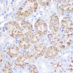 Anti-alpha 1 Antitrypsin antibody used in IHC (Paraffin sections) (IHC-P). GTX54713