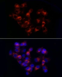 Anti-alpha 1 Antitrypsin antibody used in Immunocytochemistry/ Immunofluorescence (ICC/IF). GTX54713