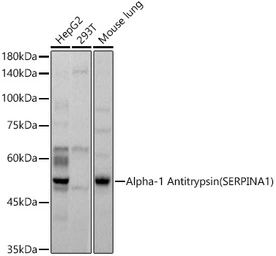 Anti-alpha 1 Antitrypsin antibody used in Western Blot (WB). GTX54713