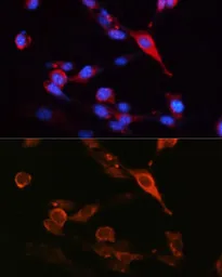 Anti-CD98 antibody used in Immunocytochemistry/ Immunofluorescence (ICC/IF). GTX54716