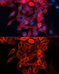 Anti-CD98 antibody used in Immunocytochemistry/ Immunofluorescence (ICC/IF). GTX54716