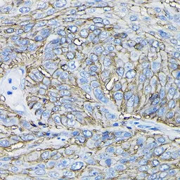 Anti-CD98 antibody used in IHC (Paraffin sections) (IHC-P). GTX54716