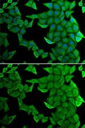 Anti-SMYD2 antibody used in Immunocytochemistry/ Immunofluorescence (ICC/IF). GTX54717