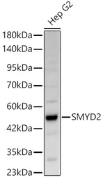 Anti-SMYD2 antibody used in Western Blot (WB). GTX54717
